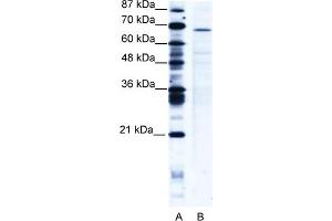 WB Suggested Anti-PSIP1 Antibody   Titration: 5 ug/ml   Positive Control: Jurkat Whole Cell PSIP1 is strongly supported by BioGPS gene expression data to be expressed in Human Jurkat cells (PSIP1 antibody  (Middle Region))