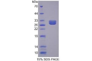 SDS-PAGE analysis of Mouse BCR Protein. (BCR Protein)