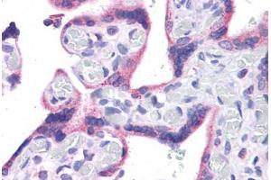 Human Placenta: Formalin-Fixed, Paraffin-Embedded (FFPE) (WT1 antibody  (C-Term))