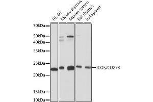 Western blot analysis of extracts of various cell lines, using ICOS/CD278 Rabbit mAb (ABIN7267869) at 1:1000 dilution. (ICOS antibody)