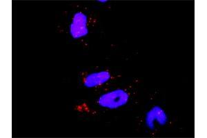 Proximity Ligation Analysis of protein-protein interactions between MAPK8 and RHOA. (RHOA antibody  (AA 1-193))