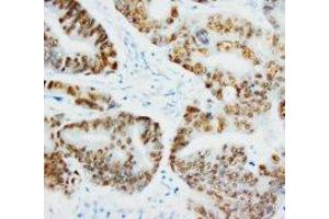 Image no. 1 for anti-Tumor Protein P53 (TP53) antibody (Magnetic Particles) (ABIN1502096)