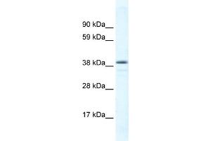 WB Suggested Anti-RORC Antibody Titration: 0. (RORC antibody  (C-Term))