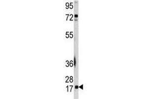 Western blot analysis of UBE2I antibody and A2058 lysate. (UBE2I antibody  (AA 1-30))