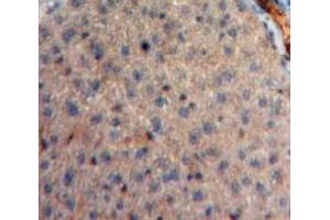 Used in DAB staining on fromalin fixed paraffin-embedded Liver tissue (Neuregulin 4 antibody  (AA 1-62))