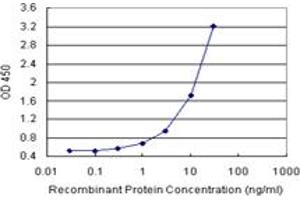 Sandwich ELISA detection sensitivity ranging from 0. (CPB1 (Human) Matched Antibody Pair)