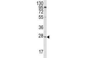 Western blot analysis of APOA1 antibody and HepG2 lysate. (APOA1 antibody  (AA 10-37))