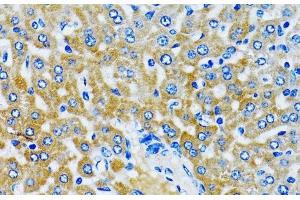Immunohistochemistry of paraffin-embedded Rat liver using HDAC5 Polyclonal Antibody at dilution of 1:100 (40x lens). (HDAC5 antibody)