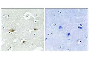 Immunohistochemical analysis of paraffin-embedded human brain tissue using STK39 (Phospho-Ser323) antibody (left)or the same antibody preincubated with blocking peptide (right). (STK39 antibody  (pSer325))