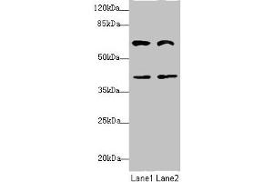 Western blot All lanes: DCP1A antibody at 3. (DCP1A antibody  (AA 303-582))