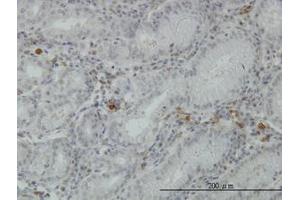 Image no. 3 for anti-Fibrinogen-Like 2 (FGL2) (AA 24-124) antibody (ABIN466173) (FGL2 antibody  (AA 24-124))