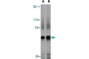 Western blot analysis of NCSTN in mouse brain tissue lysate with NCSTN polyclonal antibody  at (A) 0. (Nicastrin antibody  (Internal Region))