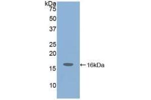 Detection of Recombinant IGF1, Mouse using Polyclonal Antibody to Insulin Like Growth Factor 1 (IGF1) (IGF1 antibody  (AA 49-153))