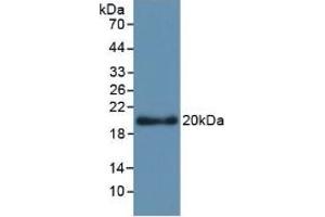 Detection of Recombinant APOL2, Human using Monoclonal Antibody to Apolipoprotein L2 (APOL2)