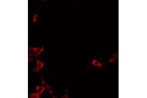 ABIN6272341 staining A549 by IF/ICC. (ST14 antibody  (Internal Region))