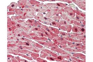 Anti-T / Brachyury antibody IHC staining of human heart. (T Brachyury Protein (AA 251-300) antibody)