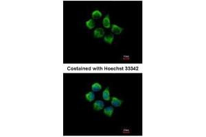 ICC/IF Image Immunofluorescence analysis of methanol-fixed A431, using SNX12, antibody at 1:500 dilution. (SNX12 antibody  (C-Term))