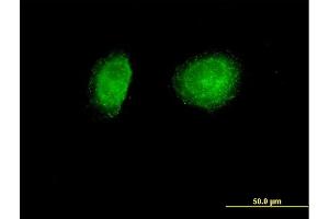 Immunofluorescence of purified MaxPab antibody to SNX1 on HeLa cell. (Sorting Nexin 1 antibody  (AA 1-522))