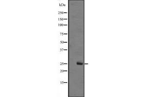 Western blot analysis of MOBKL1B expression in A431 whole cell lysate ,The lane on the left is treated with the antigen-specific peptide. (MOB1A antibody  (Internal Region))
