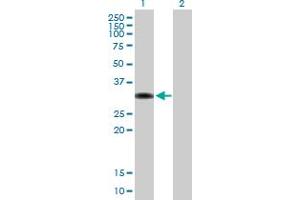 Western Blot analysis of ZBTB32 expression in transfected 293T cell line by ZBTB32 MaxPab polyclonal antibody. (ZBTB32 antibody  (AA 1-302))