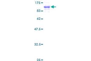 Filamin A Protein (AA 1-838) (GST tag)