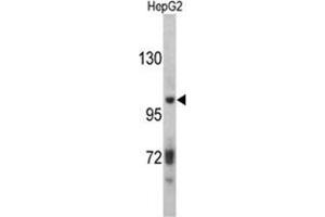 Western blot analysis of ITIH2 antibody (C-term) in HepG2 cell line lysates (35ug/lane). (ITIH2 antibody  (C-Term))