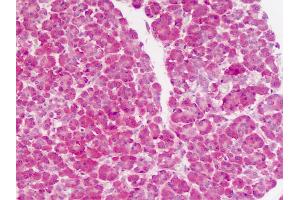 Human Pancreas: Formalin-Fixed, Paraffin-Embedded (FFPE) (PHPT1 antibody  (C-Term))