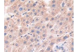 Detection of HLTF in Human Liver Tissue using Polyclonal Antibody to Helicase Like Transcription Factor (HLTF) (HLTF antibody  (AA 837-996))