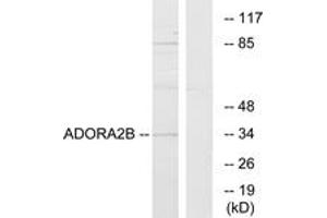 Western blot analysis of extracts from Jurkat cells, using ADORA2B Antibody. (Adenosine A2b Receptor antibody  (AA 231-280))