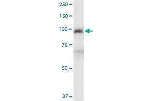 Immunoprecipitation of MCC transfected lysate using anti-MCC MaxPab rabbit polyclonal antibody and Protein A Magnetic Bead , and immunoblotted with MCC purified MaxPab mouse polyclonal antibody (B01P) . (MCC antibody  (AA 1-829))