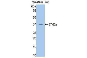 Western Blotting (WB) image for anti-Coagulation Factor II (thrombin) (F2) (AA 325-618) antibody (ABIN3207761) (Prothrombin antibody  (AA 325-618))