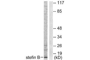 Western Blotting (WB) image for anti-Cystatin B (Stefin B) (CSTB) (Internal Region) antibody (ABIN1848780) (CSTB antibody  (Internal Region))