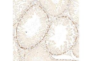Immunohistochemistry analysis of paraffin embedded rat testis using PPP2R2C (ABIN7075278) at dilution of 1: 2000