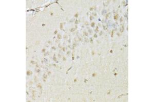 Immunohistochemistry of paraffin-embedded mouse brain using HDAC3 Antibody (ABIN5971166) at dilution of 1/100 (40x lens). (HDAC3 antibody)