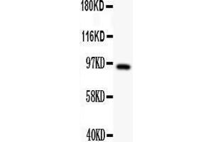 Anti- DISC1 antibody,  Western blotting All lanes: Anti DISC1 () at 0.