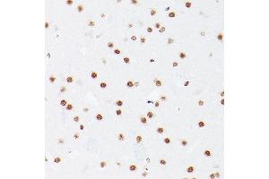 Immunohistochemistry (IHC) image for anti-NOP2/Sun Domain Family, Member 5 (NSUN5) (AA 277-466) antibody (ABIN7268955)