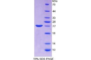 SDS-PAGE analysis of Human ECT2 Protein.