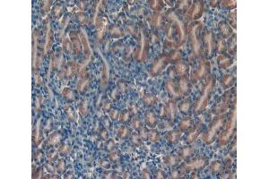 Used in DAB staining on fromalin fixed paraffin- embedded kidney tissue (NRARP antibody  (AA 3-109))
