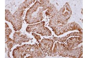 Image no. 1 for anti-Carboxylesterase 2 (CES2) (AA 310-522) antibody (ABIN1497478) (CES2 antibody  (AA 310-522))