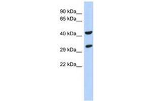 Image no. 1 for anti-Ankyrin Repeat and SOCS Box Containing 8 (ASB8) (N-Term) antibody (ABIN6741136) (ASB8 antibody  (N-Term))