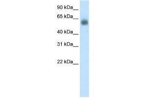 WB Suggested Anti-GRHL3 Antibody Titration: 0. (GRHL3 antibody  (C-Term))
