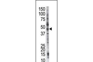 Antibody is used in Western blot to detect PSMD4 in Jurkat cell lysate.