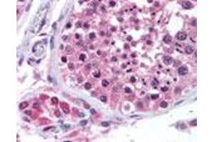 Bi-1 Immunohistochemistry. (Bax Inhibitor 1 antibody)