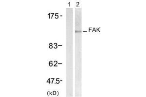 Western blot analysis of extract from H (FAK antibody)