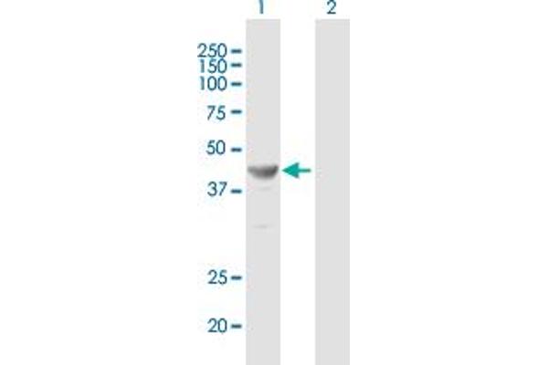 TFAP2E Antikörper  (AA 1-434)