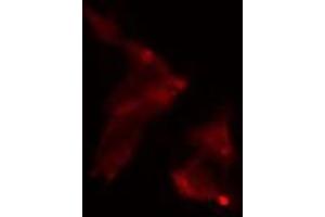 ABIN6275084 staining  LOVO cells by IF/ICC. (RNF111 antibody  (C-Term))