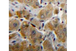 #VALUE! (Fibrinogen beta Chain antibody  (AA 45-491))