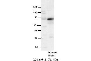 WB Suggested Anti-C21orf13 Antibody Titration:  5% Milk  ELISA Titer:  dilution: 1:500  Positive Control:  Mouse Brain lysate (LCA5L antibody  (N-Term))