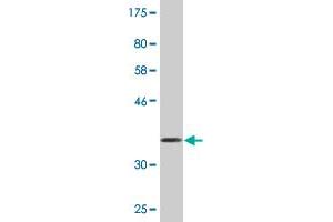 Western Blot detection against Immunogen (36. (EPH Receptor B1 antibody  (AA 221-320))
