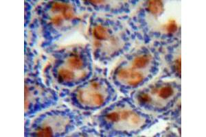 Used in DAB staining on fromalin fixed paraffin-embedded Intestine tissue (AGGF1 antibody  (AA 21-123))
